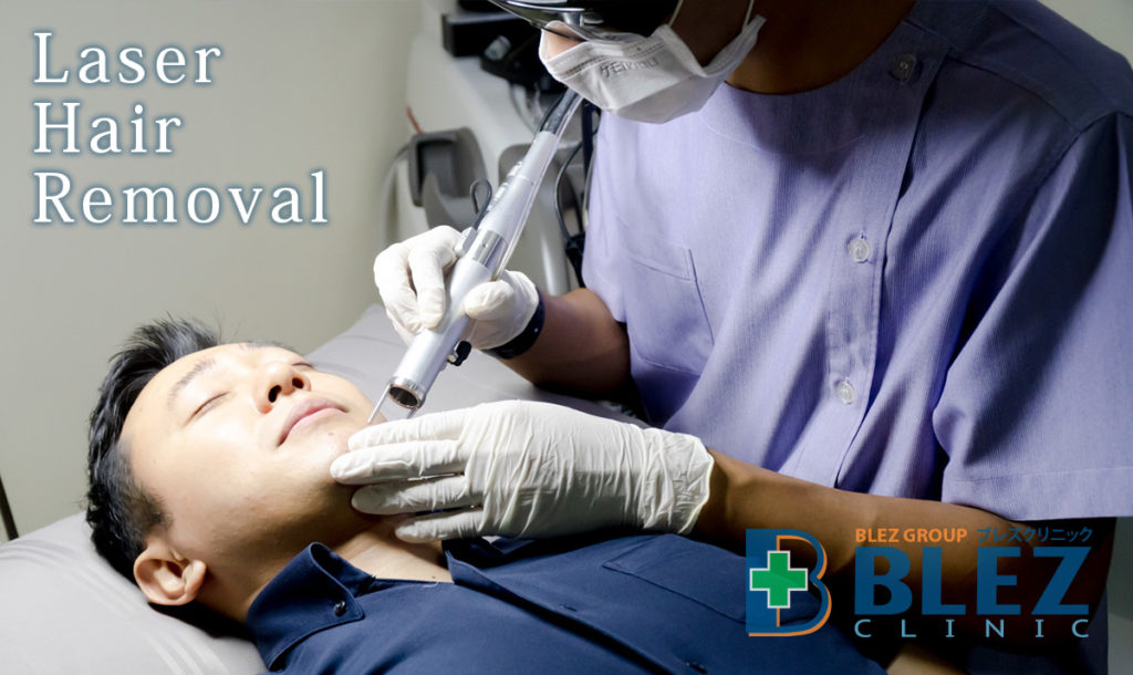 医療YAGレーザー