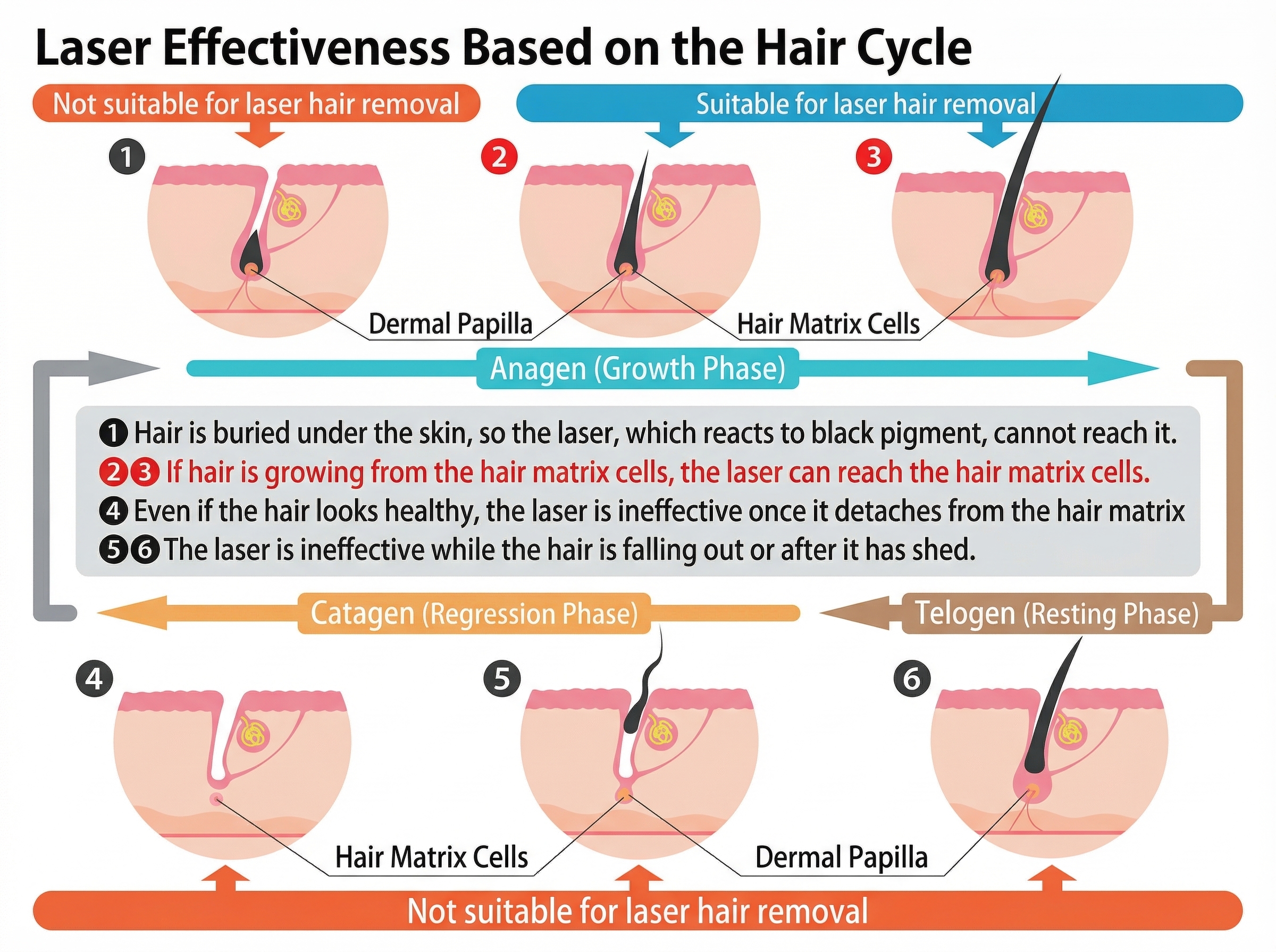 Hair Cycle and Laser Effectiveness